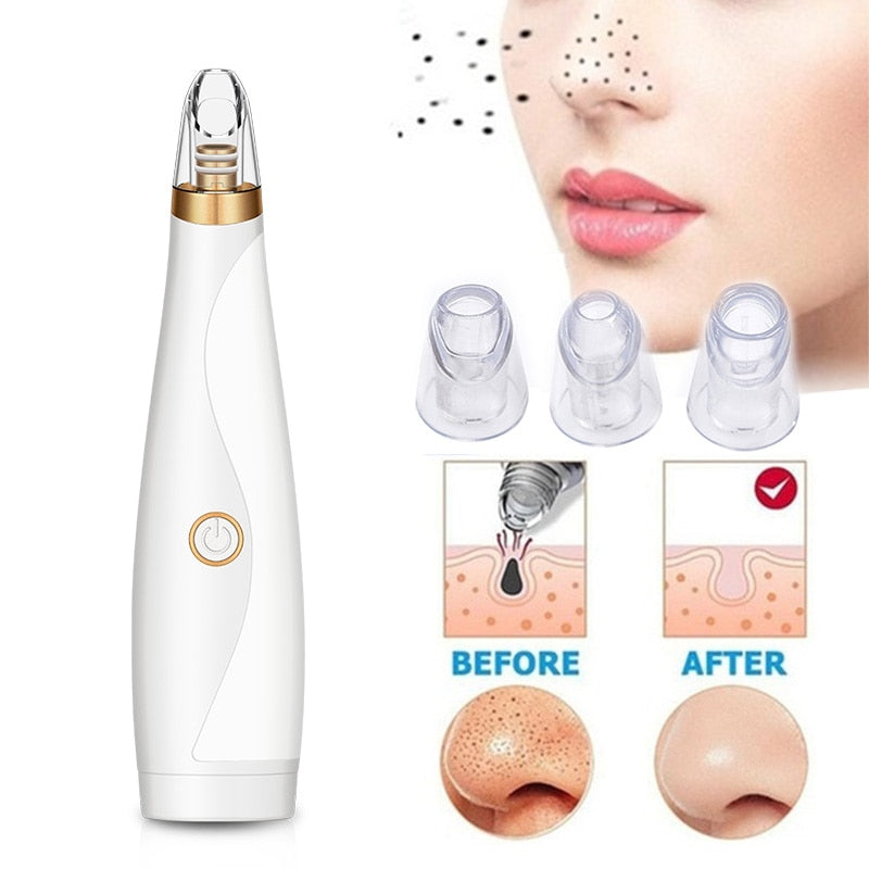 Hot Black Head Remover