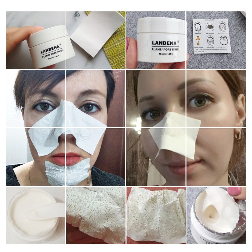 Blackhead Remover
