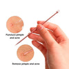 Rose Gold Acne Removal Needle